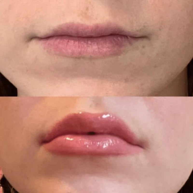 cosmelips lip plumper before after